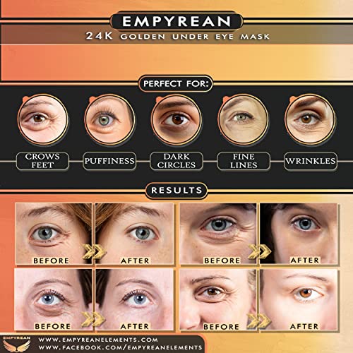 Empyrean 24-КАРАТОВО Злато маска за очи (30 двойки); Антивозрастные лепенки за грижа за кожата под очите с хиалуронова киселина и ретинол, За намаляване на фините линии, бръчки